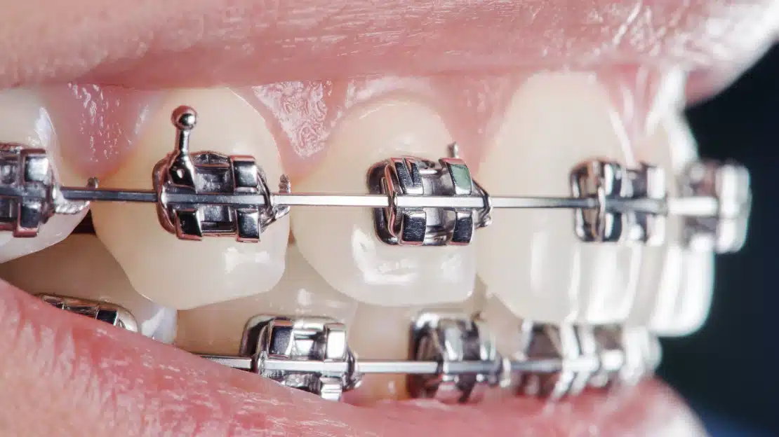 orthodontics--hamedan